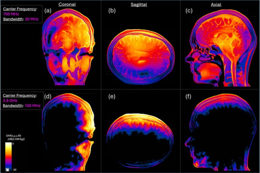 Radiation Exposure During Sleep